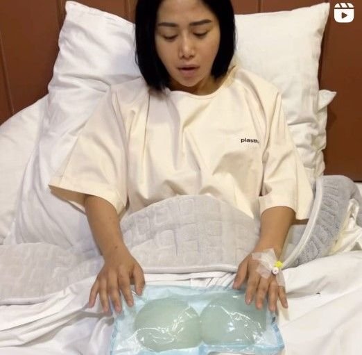 Farida Nurhan Kenang Pengalaman Implan Payudara: Badan Triplek Jauh Lebih Gembira dan Bahagia!