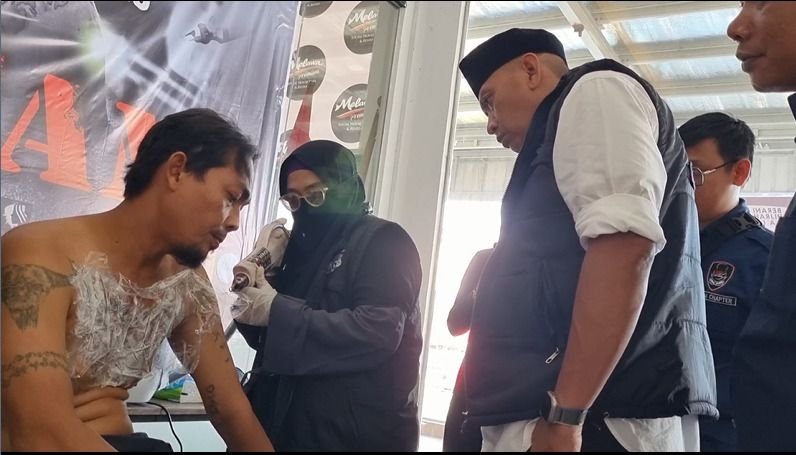 Garpu Support Kegiatan Hapus Tato Gratis di Kota Batam