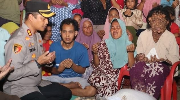 Kapolres Tapsel Bersama Forkopimda Bantu Warga Paluta Indap Penyakit Benjolan