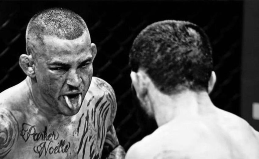 Dustin Poirier Beberkan Cedera yang Didapatkan Usai Hadapi Islam Makhachev: Hidung Patah Parah