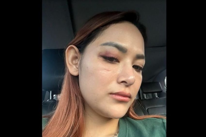 Jadi Korban KDRT, Wanita Paras Cantik Laporkan Suami ke Polisi