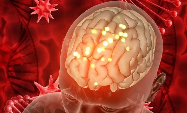 Jangan Terlambat, Kenali Gejala Stroke ini dan Langsung ke Rumah Sakit