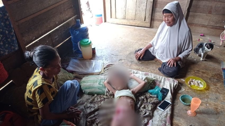 Butuh Bantuan! Anak di Padangsidimpuan Perlu Operasi, Keluarga Terhimpit Ekonomi