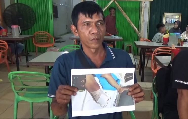 Infeksi Jari Kaki Pasien, Keluarga Mengamuk Gegara Tindakan Amputasi