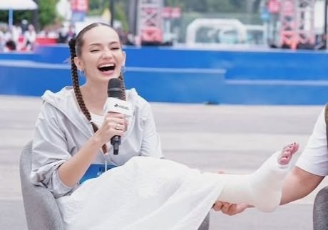 Tulang Metatarsal Enzy Storia Patah