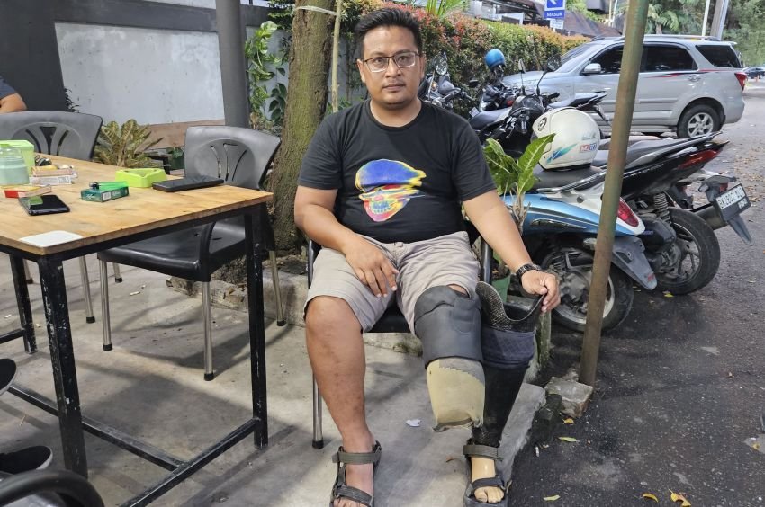 Sudah Diamputasi, Malah Dipecat: Nasib Tragis Kurir Ekspedisi di Medan