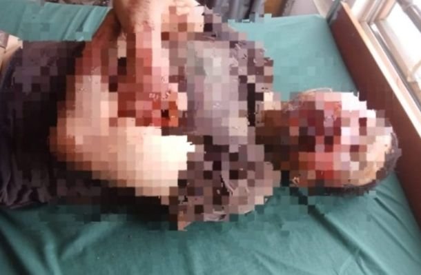 Perkelahian di Bukit Simarsayang Padangsidimpuan, Polisi Duga Seorang jadi Korban Pengeroyokan