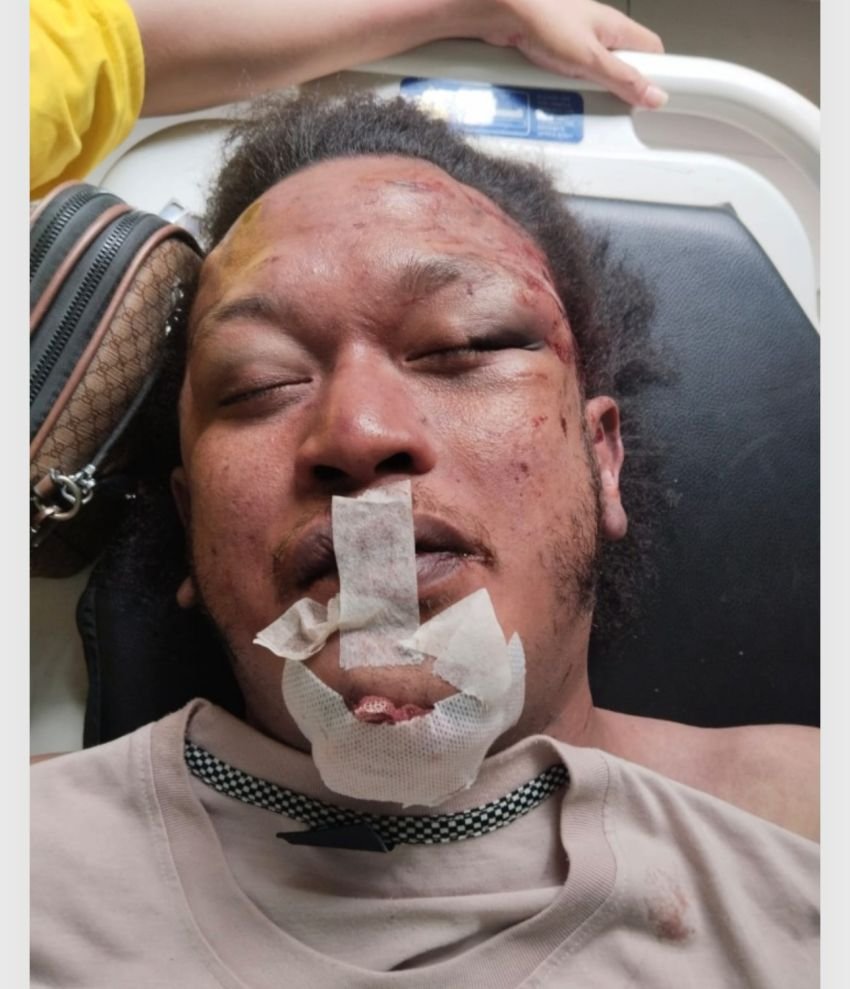 Diduga Korban Pembunuhan, Wartawan Ditemukan Tewas Dengan Sejumlah Luka