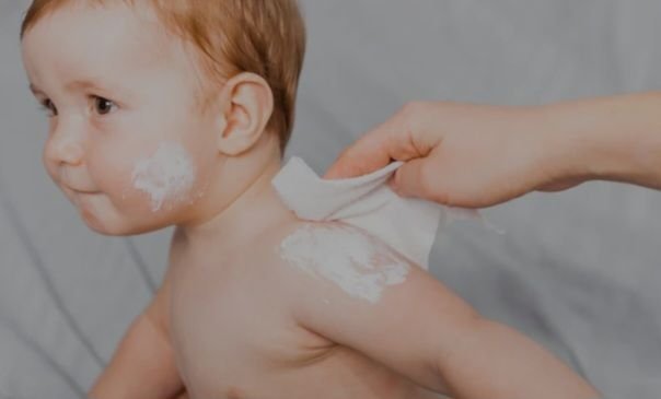 Bedak Tabur Tidak Baik untuk Bayi, Ini Kata Dokter
