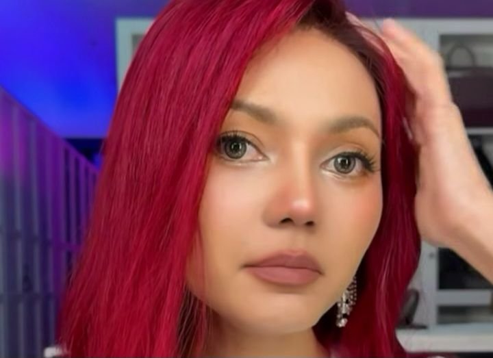Pilih Tompi untuk Operasi Plastik Hidung, Rina Nose: Local Pride