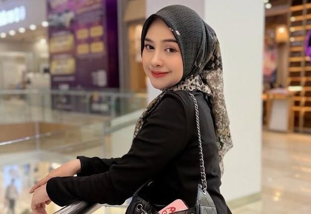 Efek Operasi Hidung, Ria Ricis Tidak Boleh Main Panas