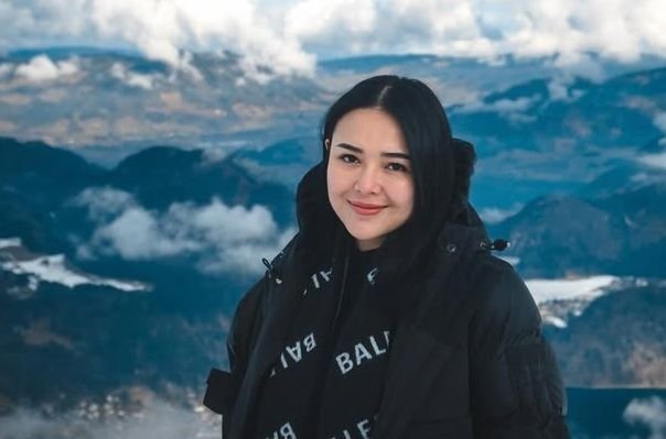 Pilih Operasi Caesar, Amanda Manopo Takut Melahirkan secara Alami