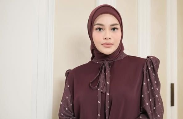Anak Jatuh dari Tangga dan Masuk Rumah Sakit, Aurel Hermansyah: Hari Terburukku Jadi Ibu