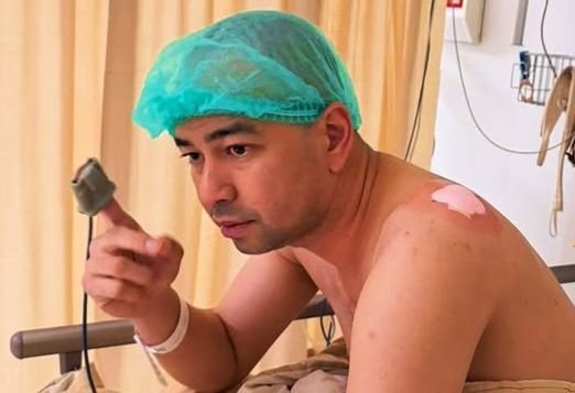 Tengah Malam Operasi Benjolan di Bahu, Raffi Ahmad: Pagi Hari Gaspol Lagi!