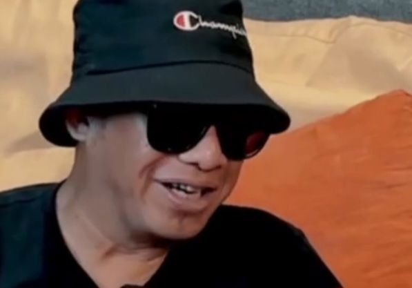 Fungsi Ginjal Tinggal 5 Persen, Trisno Pas Band dalam Pengawasan Ketat Tim Dokter