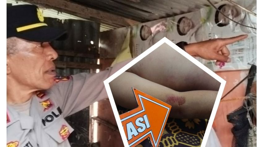 Diduga Tersengat Listrik Mesin Pompa Air, Siswa Kelas V SD di Padangsidimpuan Meninggal Dunia